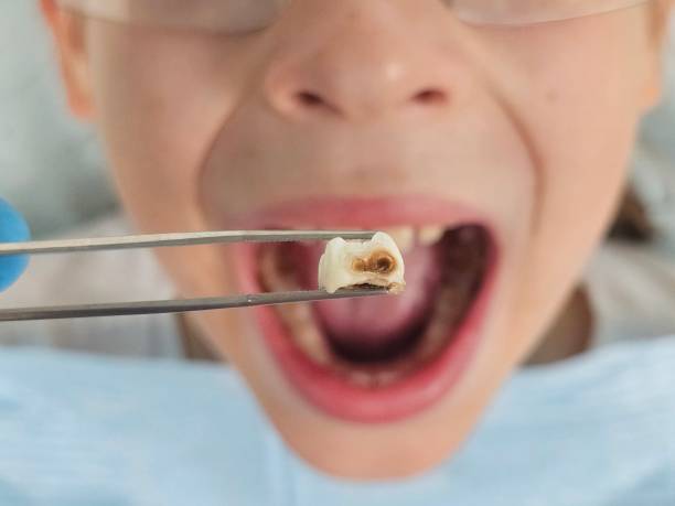 Best Emergency Cosmetic Dentistry in Emeryville, CA